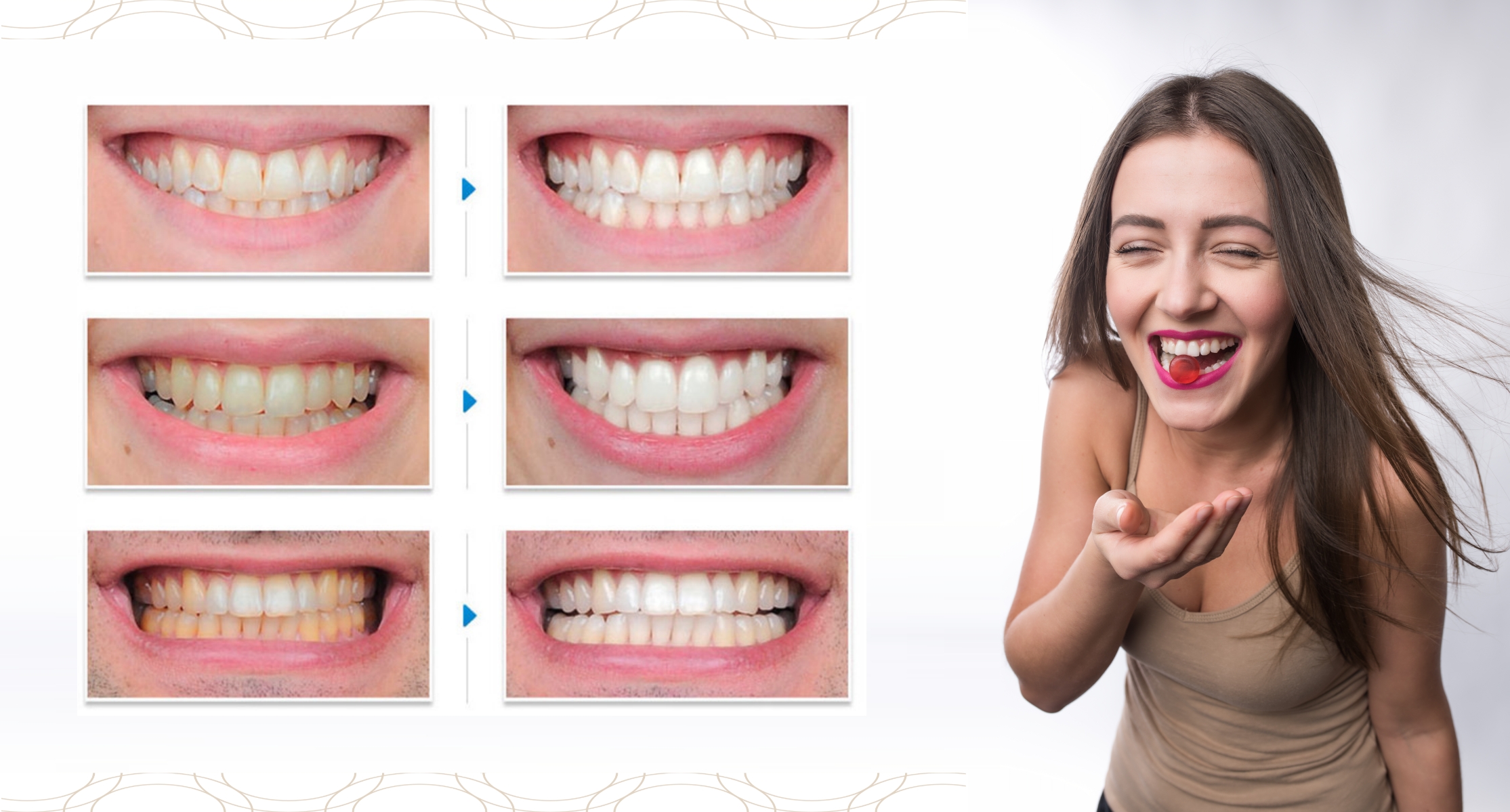 Toothy® All White - Toothyoriginal.com